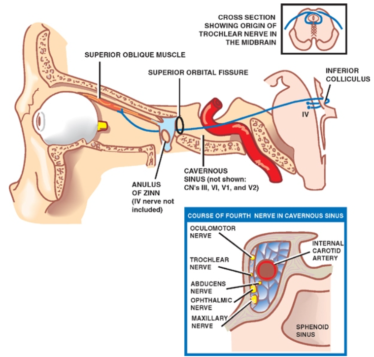 SHOWING ORIGIN OF TROCHLEAR NERVE IN THE MIDBRAIN SUPERIOR OBLIQUE MUSCLE SUPERIOR ORBITAL FISSURE INFERIOR COLUCULUS ANULUS OF nNN (IV nerve not CAVERNOUS NNUS (not shown: CNs1U, VI, VI, and V2) COURSE OF FOURTH NERVE IN CAVERNOUS NERVE TROCHLEAR NERVE ABDUCEUS NERVE OPHTHALMIC NERVE MAXILLA NERVE CAROTID ARTERY 