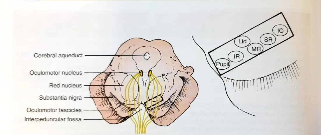 10 SR Lid pupi Cerebral aqueduct Ocuiomotor nucleus Red nucleus Substantia nigra Oculomotor fascicles Interpeduncuiar fossa Schematic diagram of midbrain at the level of superior colliculus. Proposed model of oculomotor fascic- FIGURE 8-6 ular organization in ventral midbrain tegmentum from lateral to medial is as follows: inferior oblique (10) fascicles, supe- rior rectus (SR) fascicles, medial rectus (MR) fascicles, levator palpebrae (lid) fascicles, inferior rectus (IR) fascicles and, most medially, pupillary fibers (pupil). (From Castro O, Johnson LN, Mamourian AC. Isolated inferior oblique paresis from brainstem infarction. Perspective on oculomotor fascicular organization in the ventral midbrain tegmentum. Arch Neurol. 1990;47:235—237. Copyright 1990, American Medical Association. Reprinted with permission.) 