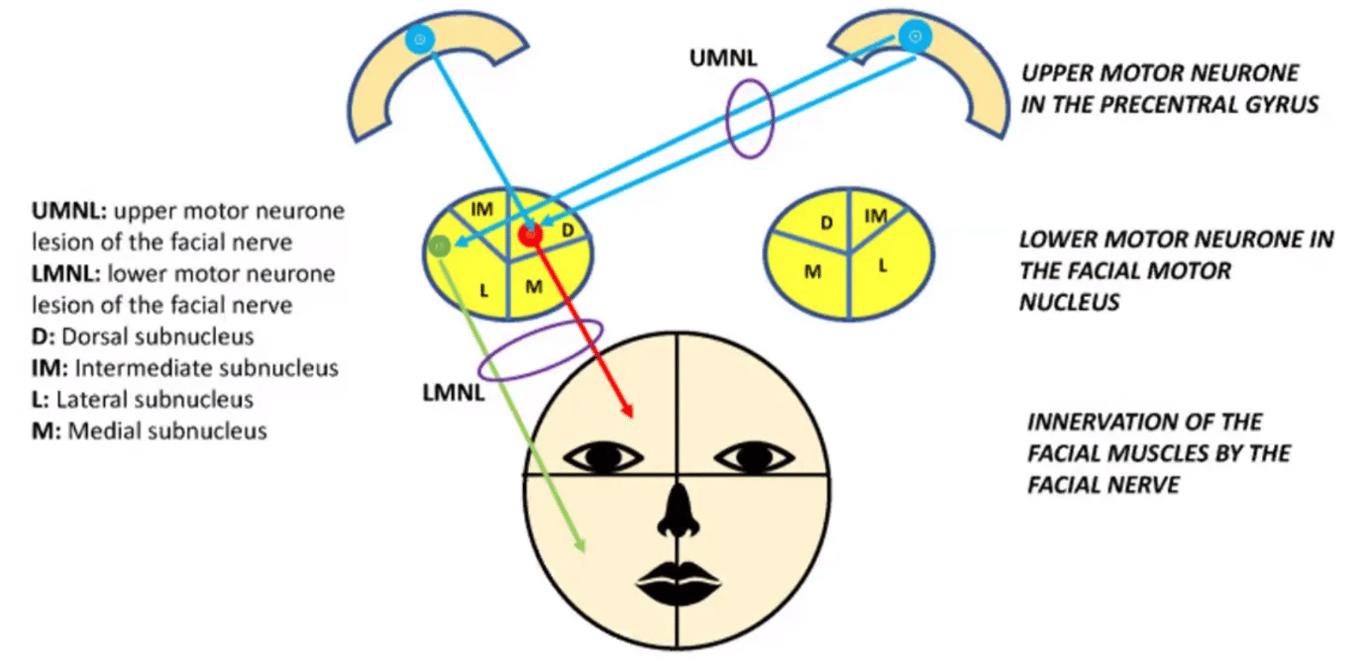 FIGURE 1: SCHEMATIC DRAWING OF THE MOTOR PATHWAY AND COMPONENTS OF THE FACIAL NERVE UMNL M UMNL: upper motor neurone lesion of the facial nerve LMNL: lower motor neurone lesion of the facial nerve D: Dorsal subnucleus 1M: Intermediate subnucleus L: Lateral subnucleus M: Medial subnucleus 1M L LMNL L M UPPER MOTOR NEURONE IN THE PRECENTRAL GYRUS LOWER MOTOR NEURONE IN THE FACIAL MOTOR NUCLEUS INNERVATION OF THE FACIAL MUSCLES BY THE FACIAL NERVE 