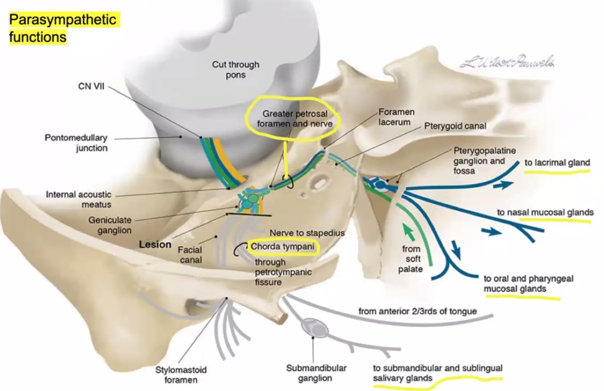 Parasympathetic functions CN Vll Pontomedullary junctbn Internal acoustic meatus Geniculate lion Cut through pons Greater petrosal foranwn and-nerve Nerve to stapediuS Chorda tympani through petrotympanic fissure Submandibular ganglion Foramen from palate Pterygoid canal Pterygopalatine ganglion and to lacrimal gland to nasal mucosal glands to oral and pharyngeal mucosal glands Lesion Facial Stylomastoid foramen from anterior 2/3rds of tongue to subrnandibular and sublingual salivary glands 