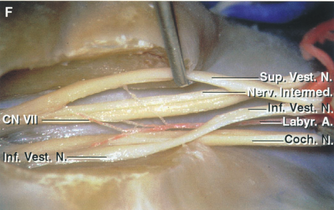 CN.vi1 Iil. est. —-Labyr. A. Coch 