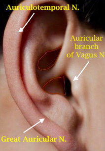 Close-up of an ear with arrows pointing to the side AI-generated content may be incorrect.