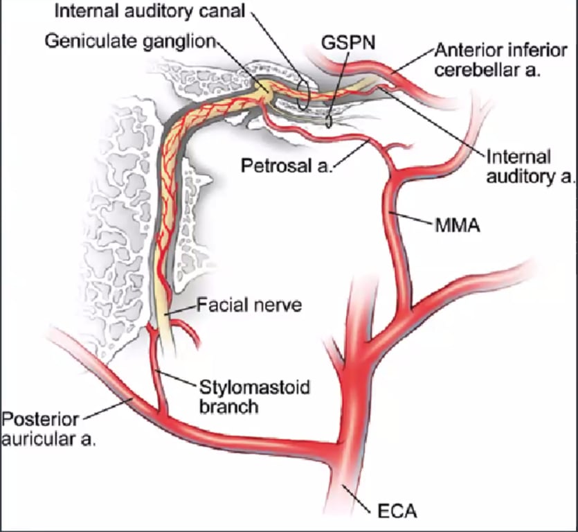 Internal auditory canal Geniculate ganglio GSPN Anterior inferior cerebellar a. Internal auditory a. MMA Petrosal a. acial nerve Stylomastoid branch osterior uricular a, ECA 