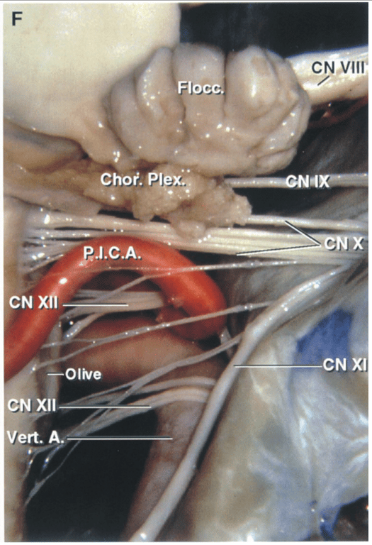 Enlarged view of the lateral recess