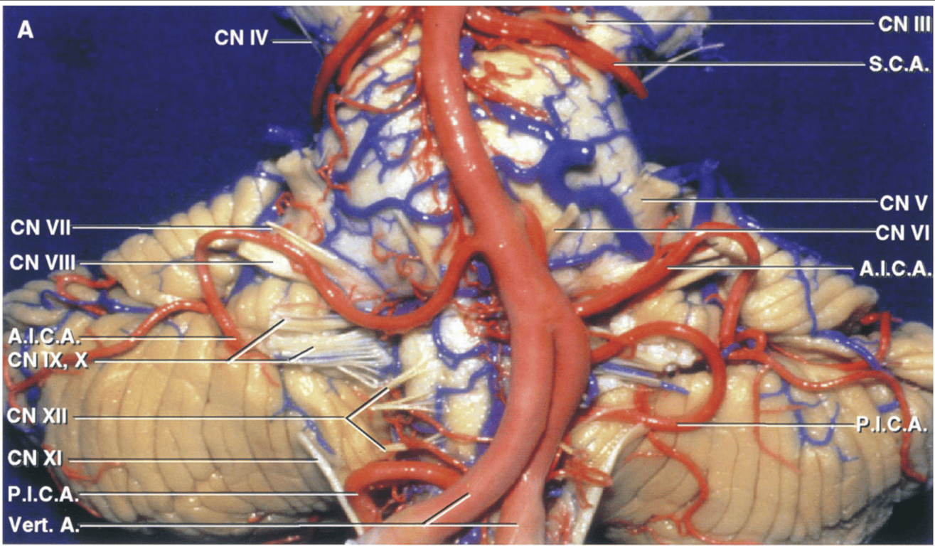 Anterior view of the brainstem and cerebellar arteries.