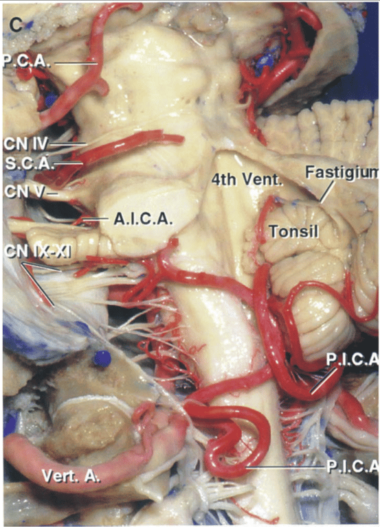Enlarged oblique view