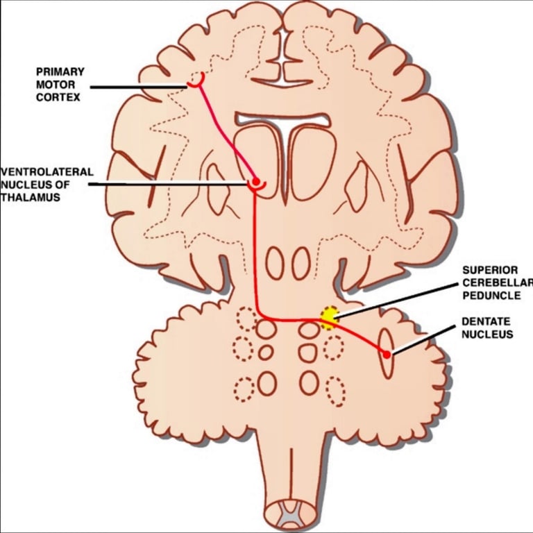 PRlMARY MOTOR CORTEX ENTROLATERAL NlJCLElJS 0F HALAMlJS ςυΡΕΑΙOΑ CEREBELLAF PEDUNCLE DENTATE NlJCLElJS 