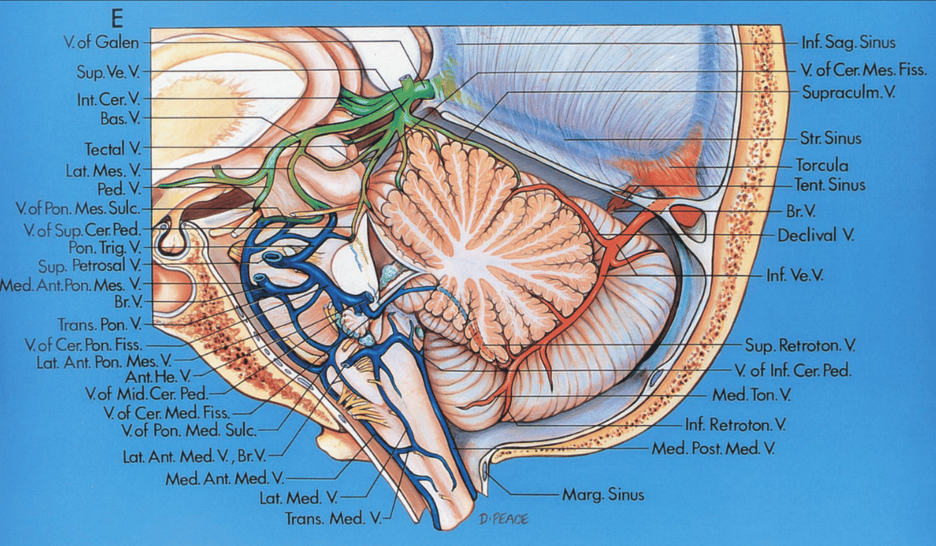 Midsagittal section of cerebellum and fourth ventricle, left lateral view. The left half of the cerebellum has been removed to expose the fourth ventricle. 