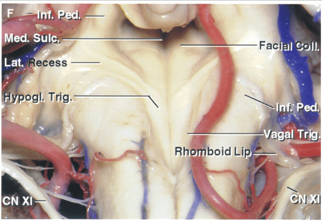Enlarged view showing the relationship of the PICAs to the fourth ventricle