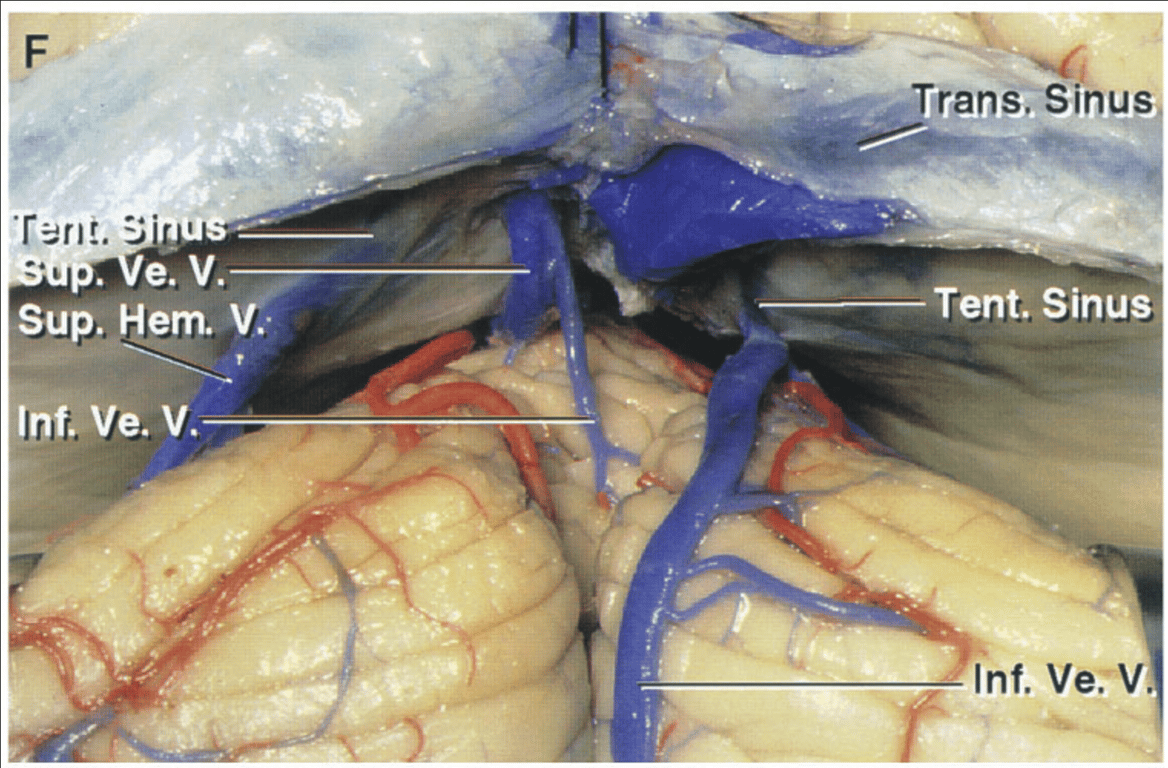 Enlarged view of another cerebellum