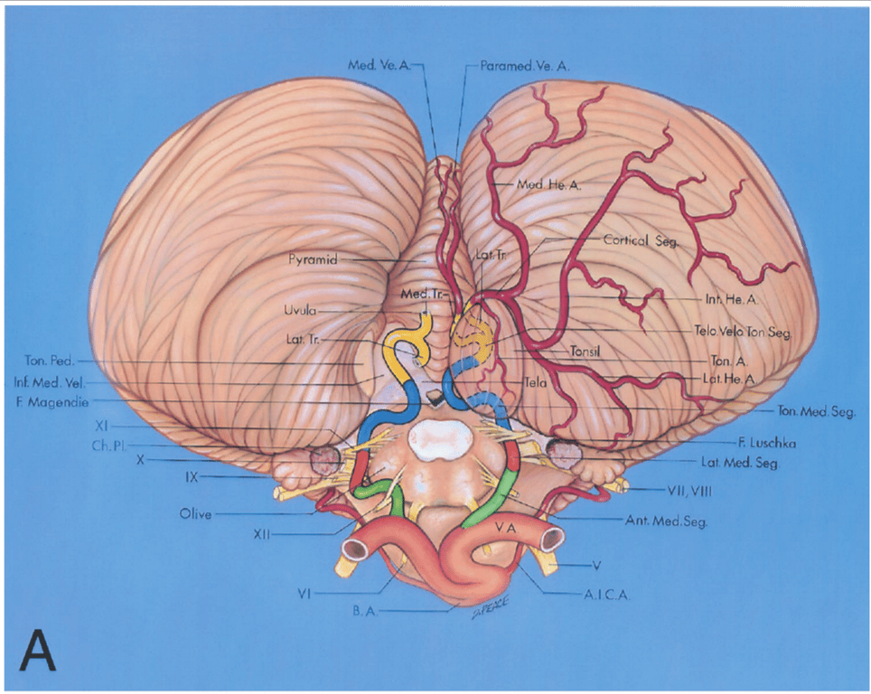Inferior view. The left tonsil has been removed at the level of the tonsillar peduncle, its site of attachment to the remainder of the hemisphere.