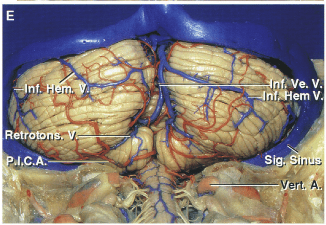 Another cerebellum