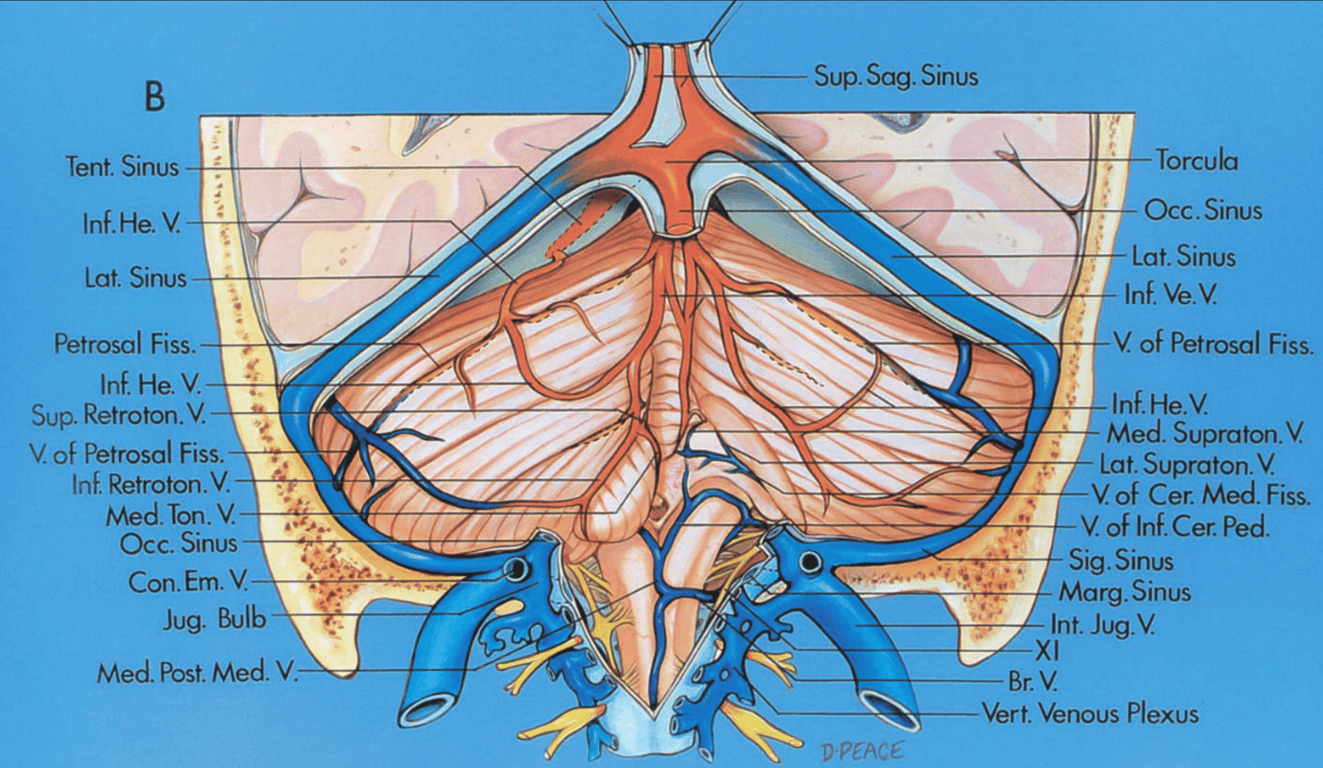 Suboccipital surface, posterior view. The right tonsil and the medial part of the biventral lobule have been removed to expose the structures on the ventral wall of the cerebellomedullary fissure. 