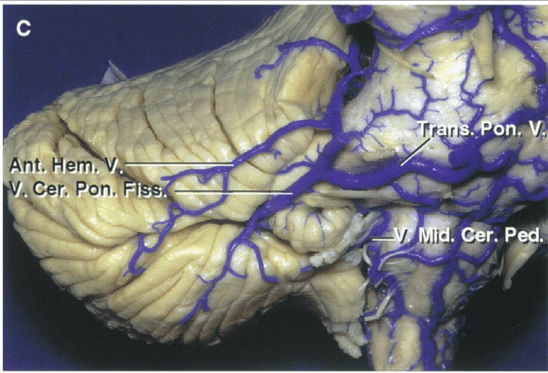 Enlarged view of the right petrosal surface