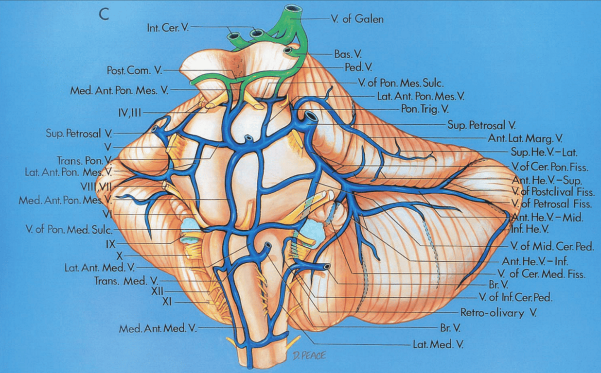 Petrosal surface and left side of the brainstem, anterolateral view
