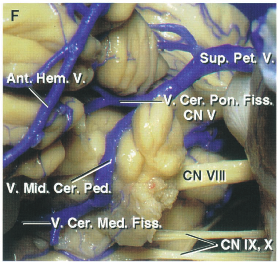 X 'XI NO •paw •A— IIIA N RNO •dns 