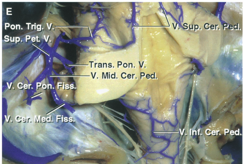 Pon. Trig: . up. pet. Pon. V. V. Mid. cer.ped. v. cei. .æ.' V. cur. . Cer. 