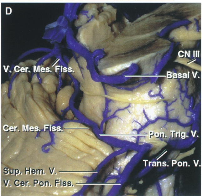 V. Cer. Mes. cer. Mes. Fi ,•Hem. V, . Cer.+on. Fiss. Trans. on. V. 