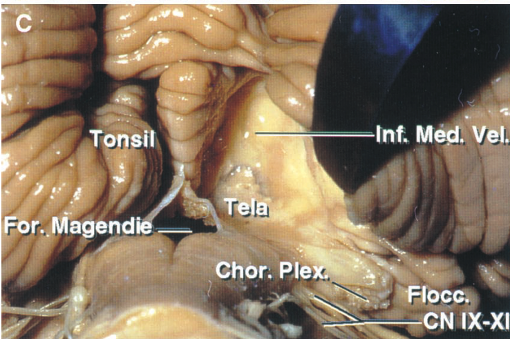 Tor"il Int. Méd. vel. Chor. • CN IX-XI 