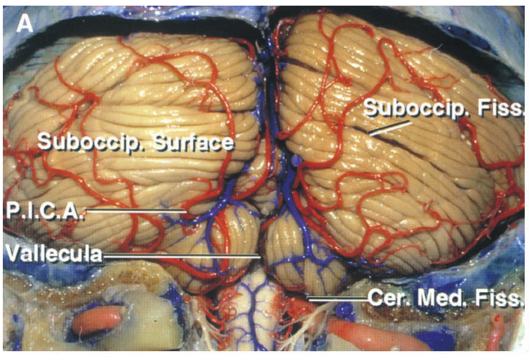 Close-up of a human brain AI-generated content may be incorrect.