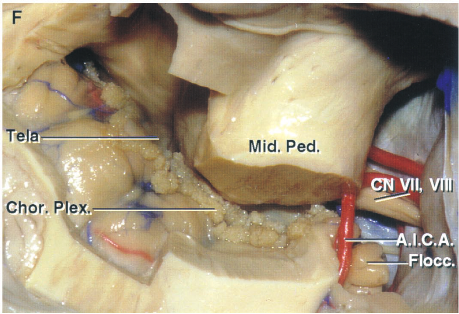Mid. Ped. VII, V Chor. 