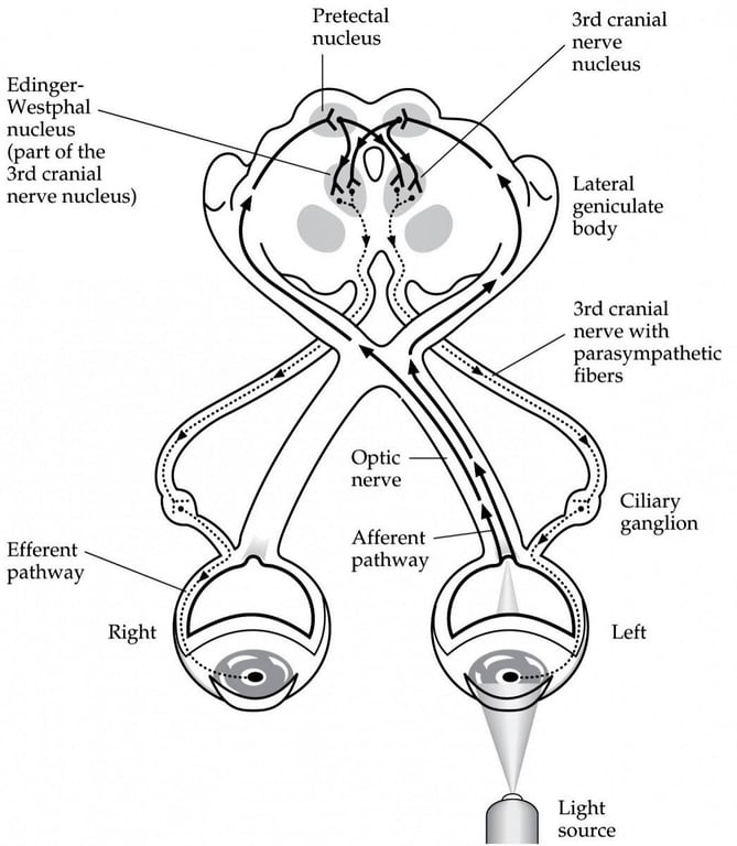 Edinger- Westphal nucleus (part of the 3rd cranial nerve nucleus) Efferent pathway Right Pretectal nucleus Optic nerve Afferent pathway 3rd cranial nerve nucleus Lateral geniculate body 3rd cranial nerve with parasympathetic fibers Ciliary ganglion Left Light source 