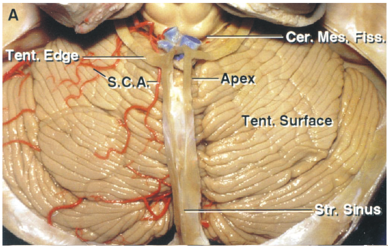 S.CA, Cer. M -Apex 'ent. SGrface 