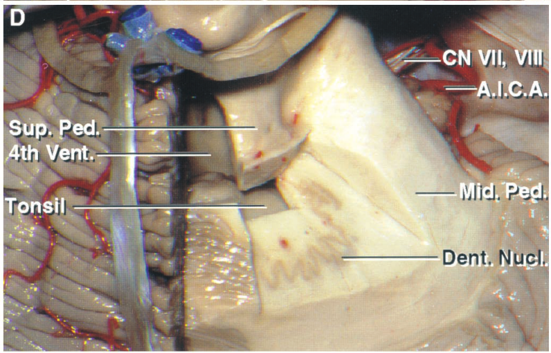 CN W, A',l.e.A. Ath Vent Dent. Nu 