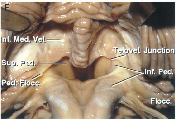 peci:.goc i. unction Inf. Ped. -Flocc. 
