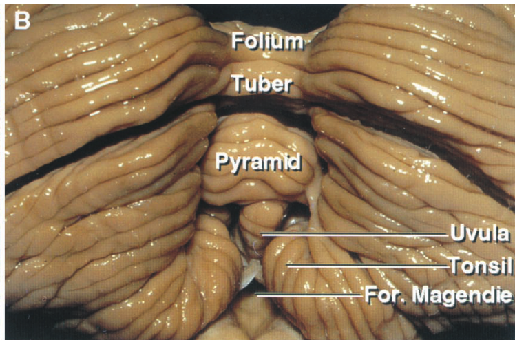 Close-up of a human intestine AI-generated content may be incorrect.