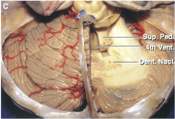 A close-up of a human body AI-generated content may be incorrect.