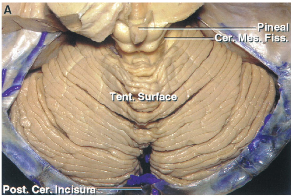 ineal iss. Post. Ceräncisürm 