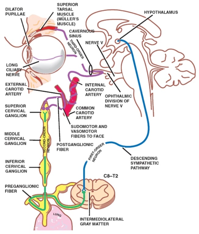 DILATOR PUPILLAE CILIA NER E EXTERNAL CAROTID ARTERY SUPERIOR CERVICAL GANGLION MIDDLE CERVICAL GANGLION INFERIOR CERVICAL GANGLION PREGANGUONIC FIBER SUPERIOR TARSAL MUSCLE (MOLLERS MUSCLE) CAVER NERV INTERNAL CAROTID ARTERY OPHTHALMIC DIVISION OF NERVE V COMMON CAROTID SUDOMOTOR AND VASOMOTOR FIBERS TO FACE POSTGANGLIONIC FIBER HYPOTHALAMUS DESCENDING SYMPATHETIC PATHWAY C8-T2 INTERMEDIOLATERAL GRAY MATTER 