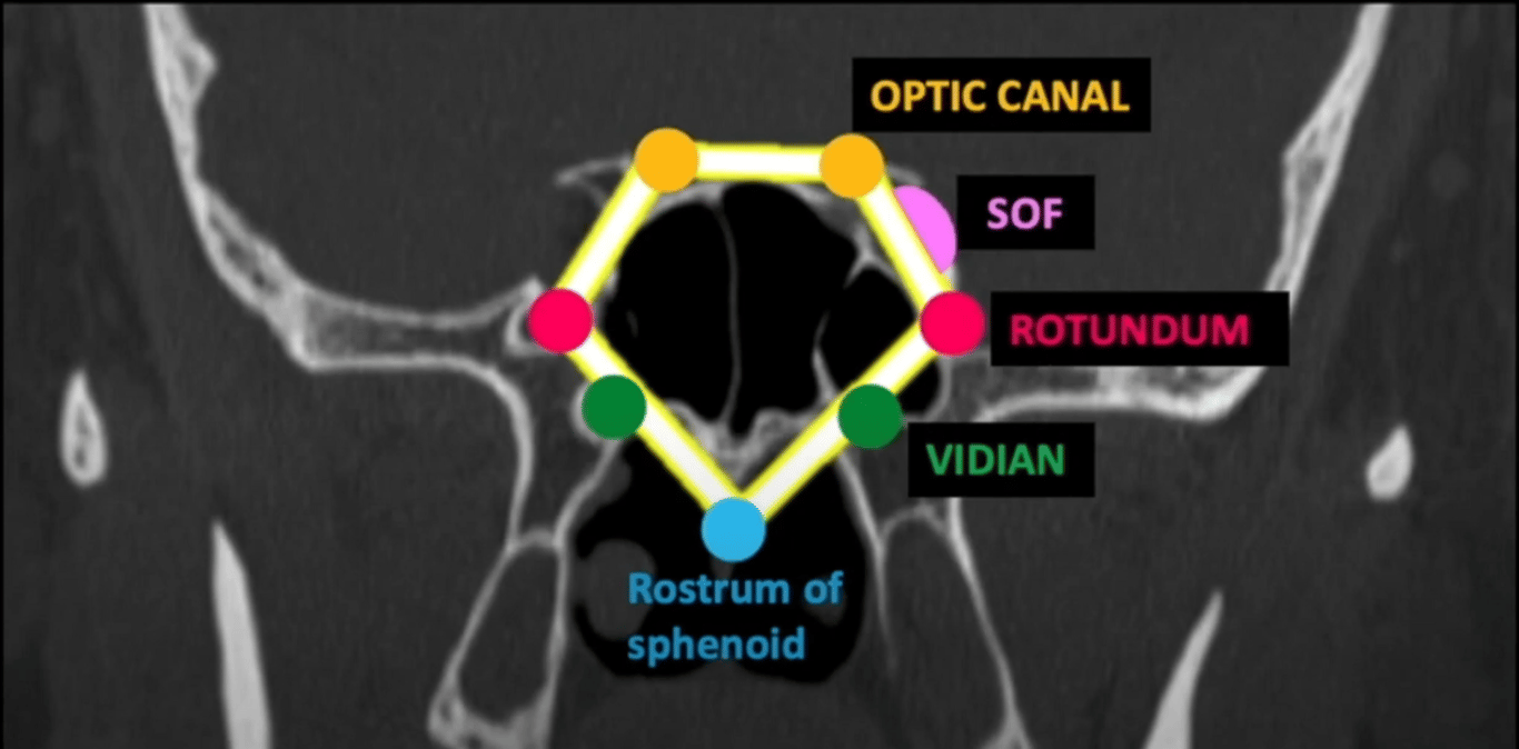 The sphenoid pentagon