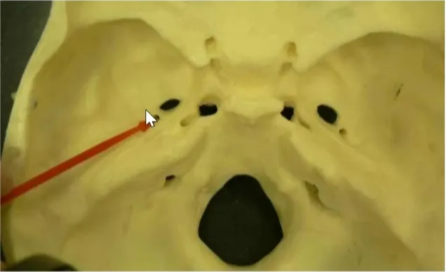 Foramen spinosum + It's an aperture in the greater wing Of the sphenoid posterolateral to foramen ovale. + Contents :- + l) Middle meningeal artery & vein. 2) Emissary vein. 3) Nervous spinosus (Meningeal branch of mandibular nerve Foramen Lacerum + It's located at the base of medial pterygoid plate, ant to the petrous apex. + Structures passing whole length: I )Meningeal branch of Ascending pharyngeal artery 2) Emissarwein Other structures partially traversing: 3) Internal carotid ariery d) Greater petrosal nerve. 