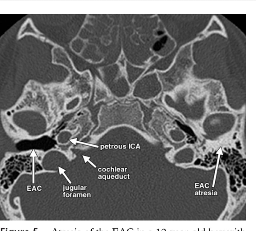 An x-ray of a skull AI-generated content may be incorrect.
