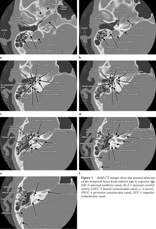 A collage of images of the skull AI-generated content may be incorrect.