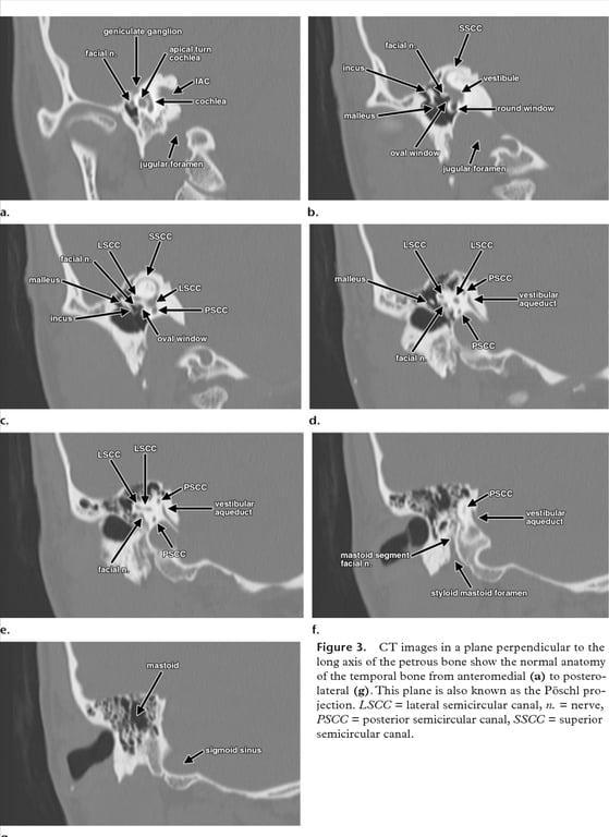 A close-up of a mri AI-generated content may be incorrect.