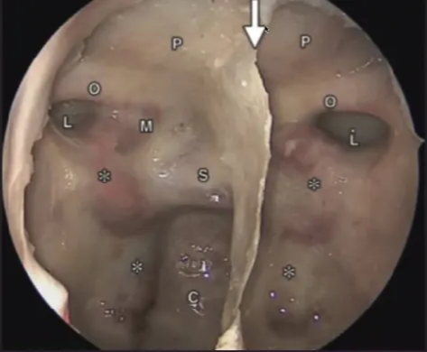 A close-up of a human body AI-generated content may be incorrect.