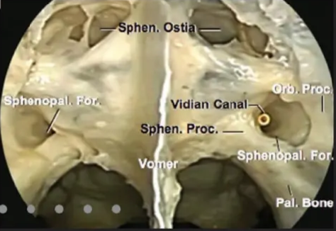 phen. Osti heno>al. S Vidian canal . proc. — 