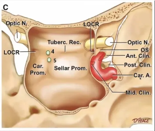 c LO R Clin. Lg Tuberc. Rec. 04 Car. Sellar Prom. Prom. Optic NC Ant. 1• Post in. t. Clin. Car. Mid. Clin. Diaph Post. Clin. Optic N. Opt. Car. Elev. Tuberc. 4 Pit. Gland ar. in. Ring 