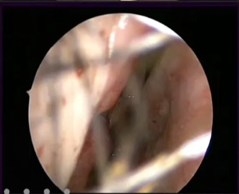 A close-up of a human body AI-generated content may be incorrect.