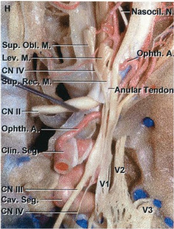 sup. Obi. M, Lev. M.. CN 11 Ophthlt: cave seg. 