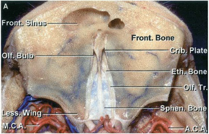 Front. Bone Plate t one '?.fron- s Ing 