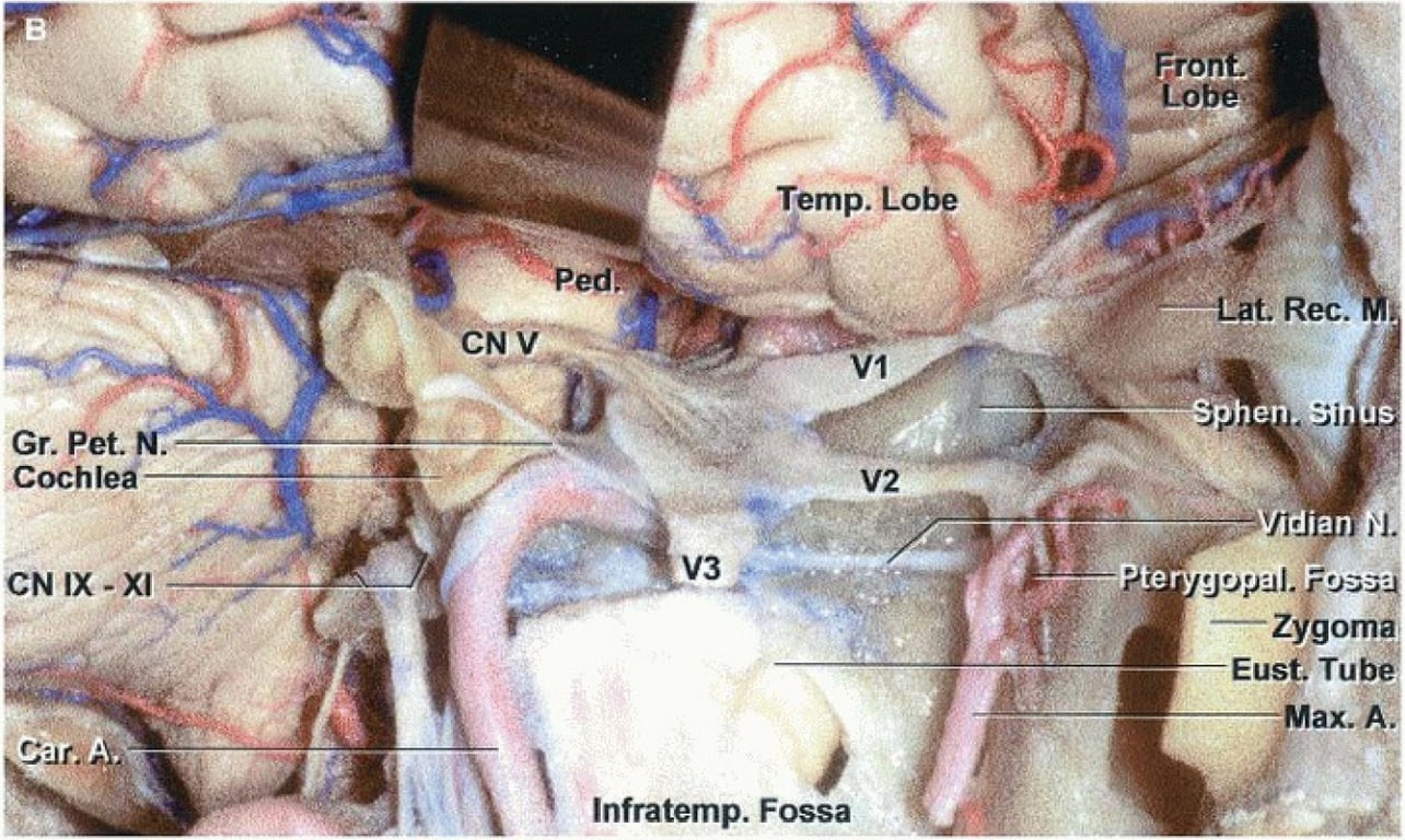 cNo Gr. pet cochlea Temp. Lobe Infratemp. Fossa ' ••'öf>eat. Rec. Z gom Eust, Tu Max. 