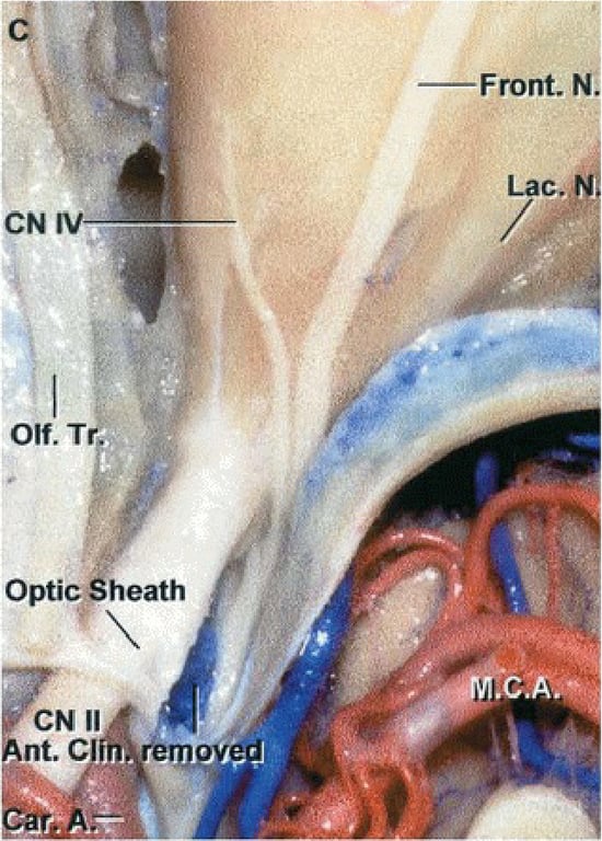 -——front. ос. 0PtiC sneath 