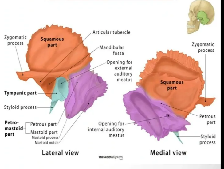The Temporal bone The bone Can be divided into main parts: squamous petromastoid, and tympanic 1. Squamous Part Also Called 'he squamo it 'S the part Of the bane, located This and plate-like par' 'he lateral the middle Cnänial I'S Outer is Sme•ath and S5ghtty convex and a the On the its inner surface is Concave, bearing impressions of lobe, the felds Iy_llci and gyriL The inner surface also has C ttwough Which the middle meningeal Vessels Temporal Bone Anatomy Lateral view Medial 