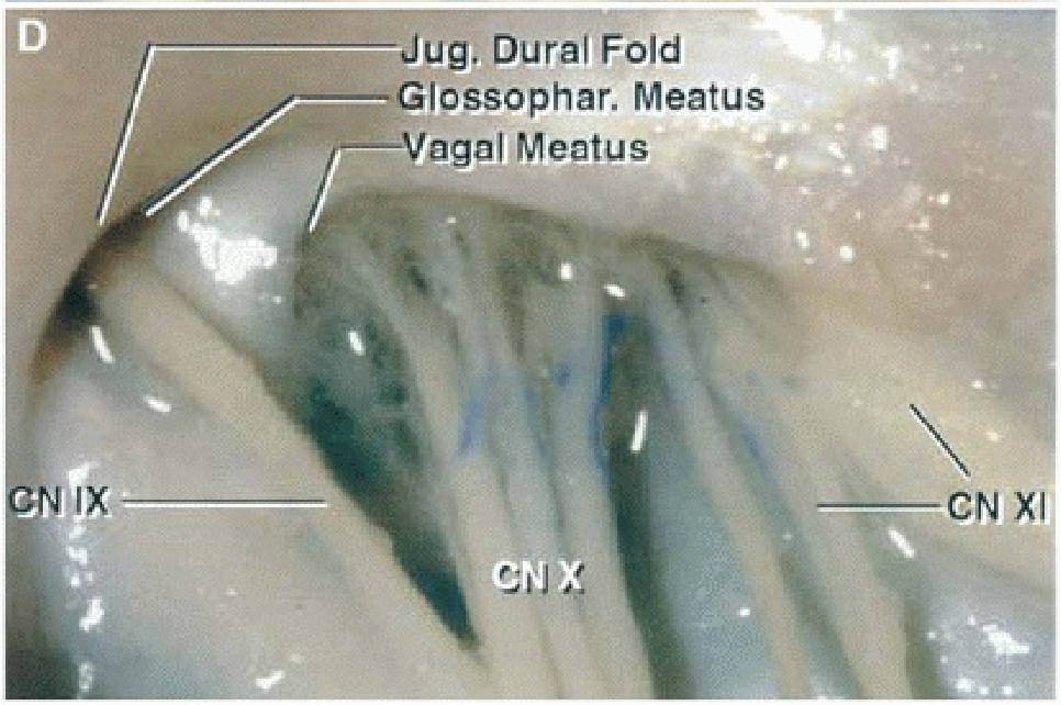 Enlarged view of two jugular foramina