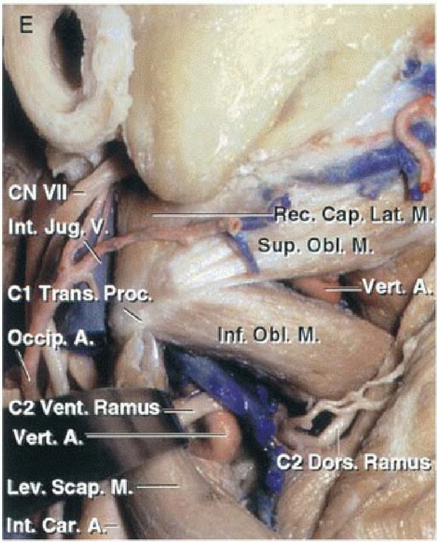 •fiffl : azo •łqo •opłd u LO •łqo •dns 'deo •oa ânr •łuł 