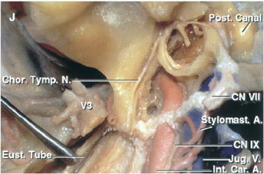 or.Tymp. Ν Ν νιι lomst. Α. c ιχ lnt. Ca . Α. 